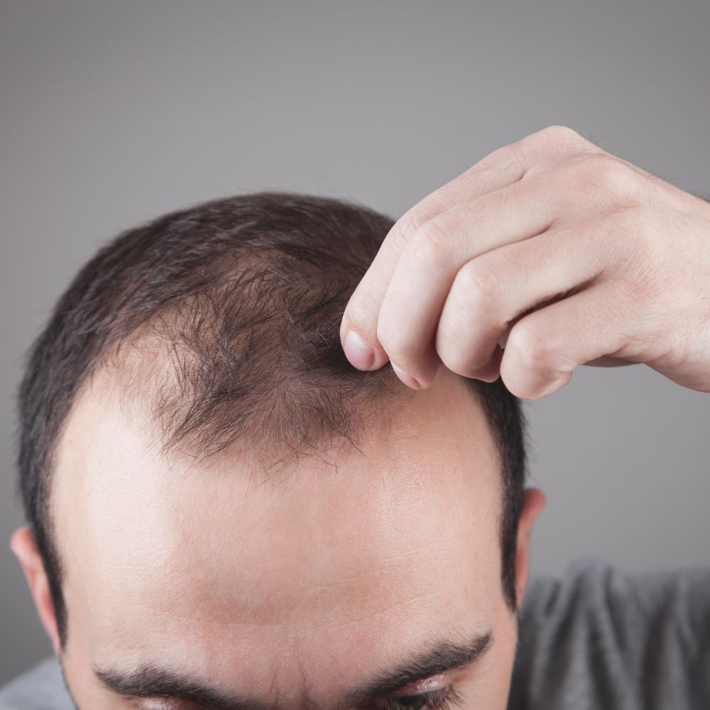 Rotlicht gegen Haarausfall - wie rotes Licht dem Haarwachstum hilft. Oder: die letzte Behandlung, die du vielleicht je brauchen wirst