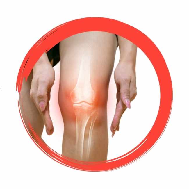 Roter Kreis Icon Schmerzendes Knie